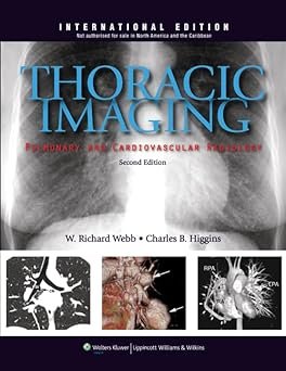Thoracic Imaging - Richard web & Charles higgins.